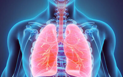 Radioinmunoterapia en adenocarcinoma de pulmón oligometastásico con masa bulky compleja y pdl-1 negativo: técnica pathy.